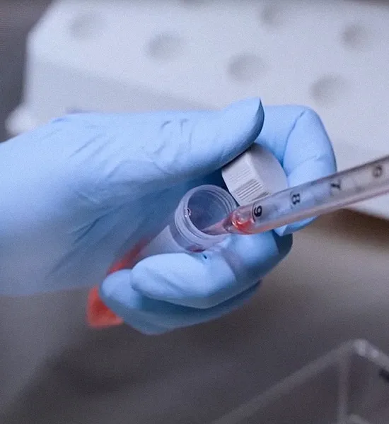 Eppendorf Harvesting 2